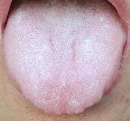 喉嚨感覺(jué)有東西堵著是怎么回事，解析癥狀與原因，喉嚨感覺(jué)有東西堵著的原因及癥狀解析