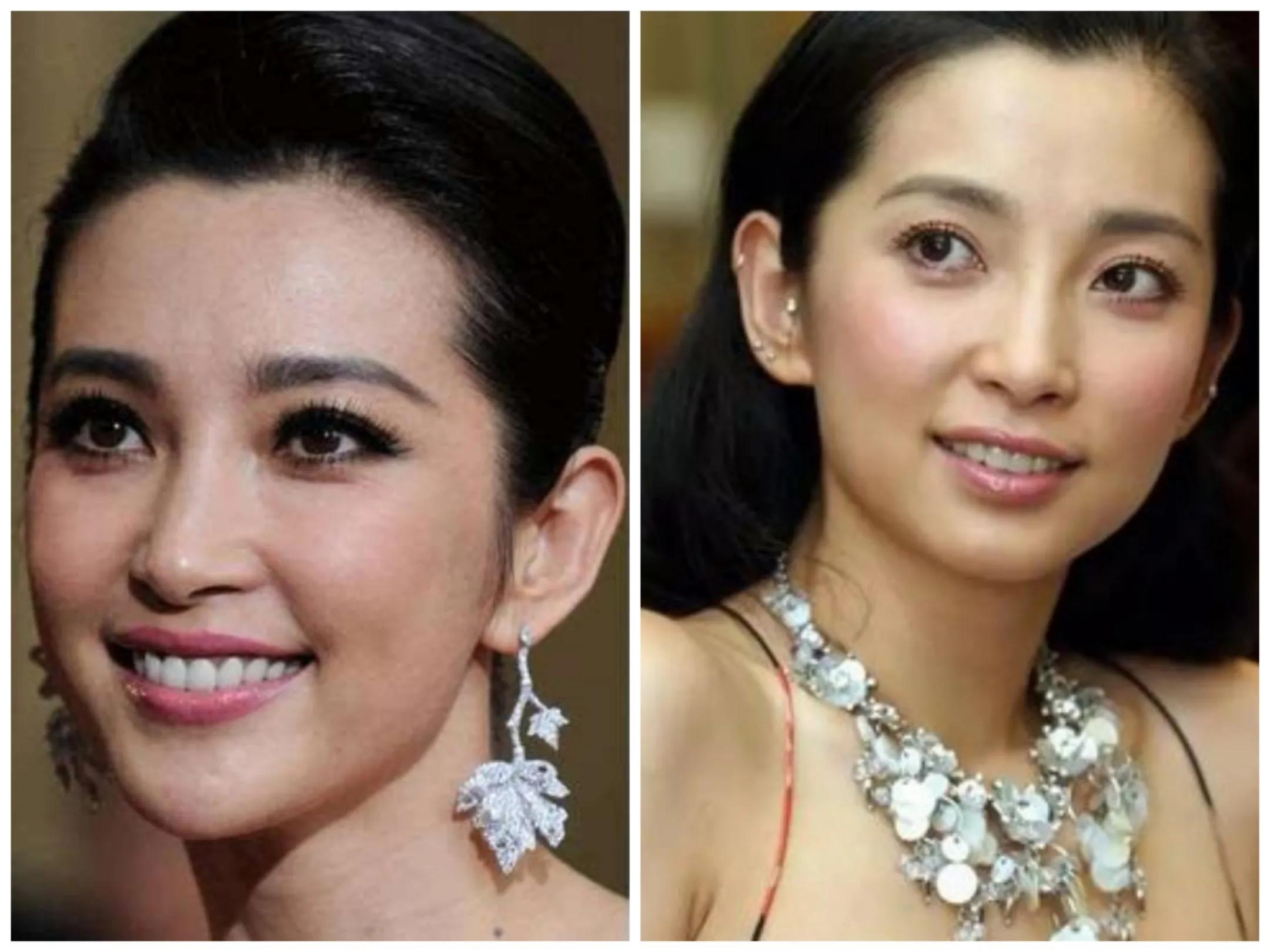 整容最嚴(yán)重的女星，探究過度整容背后的故事與挑戰(zhàn)，探究女星過度整容背后的故事與挑戰(zhàn)，整容最嚴(yán)重的女星揭秘