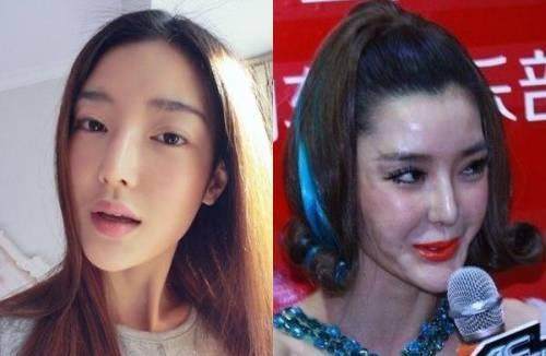 因整容而毀容嚇人的明星，背后的故事與反思，整容失敗背后的明星故事與反思，整容變毀容的警示與探究