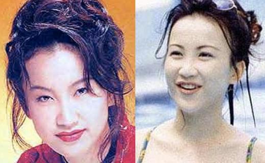 整容后的女明星們，變化背后的故事，女明星整容背后的故事揭秘