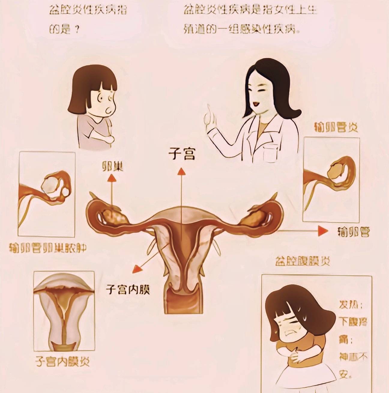 婦科炎癥，了解、預(yù)防與治療，婦科炎癥，全面解析預(yù)防與治療方法